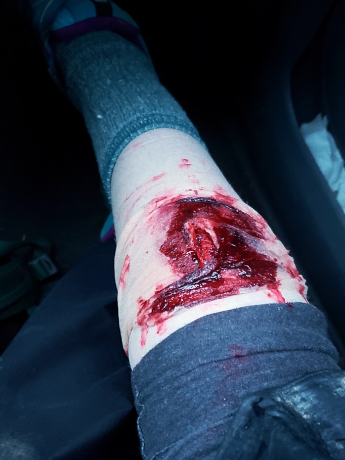 Fotor_155032393954631